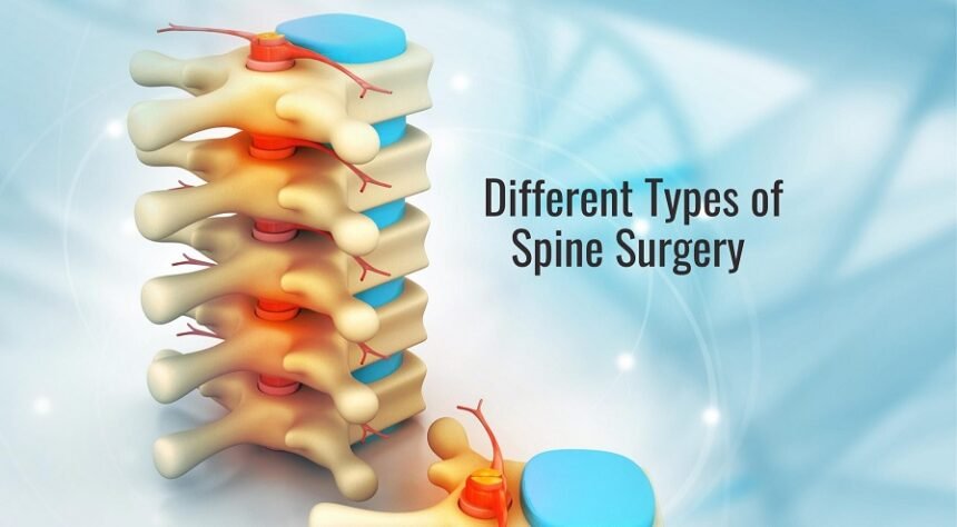 2 Types of Disc Surgery