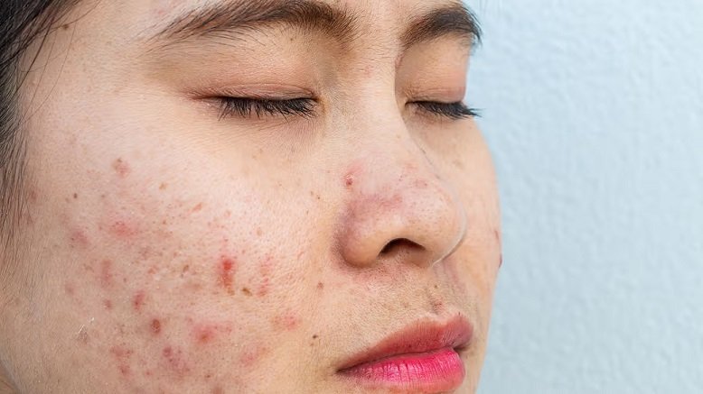 2 Skin Conditions a Dermatologist Treats